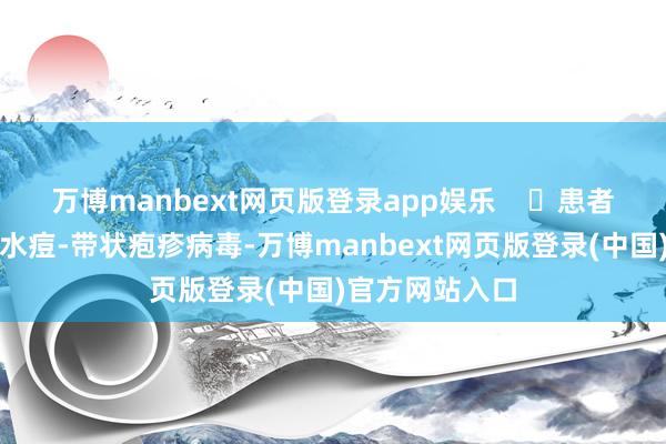 万博manbext网页版登录app娱乐    ⭐患者水疱液中含有水痘-带状疱疹病毒-万博manbext网页版登录(中国)官方网站入口